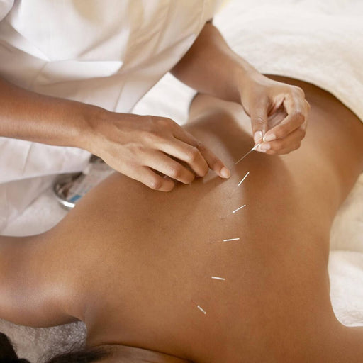 Fort Worth Wellness Club Acupuncture Package